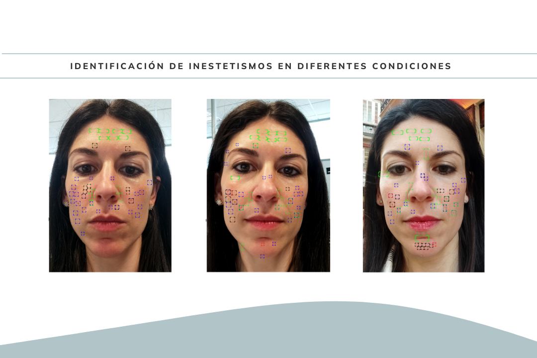 Identificación-problemas-de-piel-iMstantScan4D
